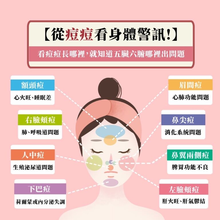 痘痘位置圖